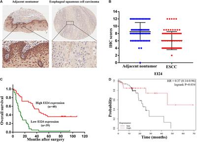 EI24 Inhibits Cell Proliferation and Drug Resistance of Esophageal Squamous Cell Carcinoma